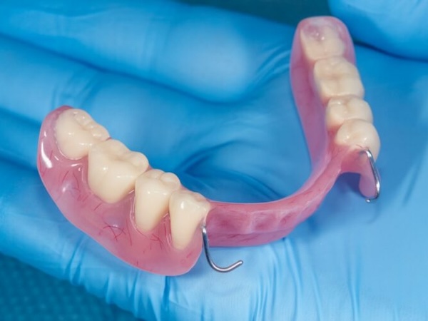 Partial Dentures